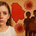 Alerta por brote de sarampión