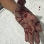 La mano que tronó el cuete